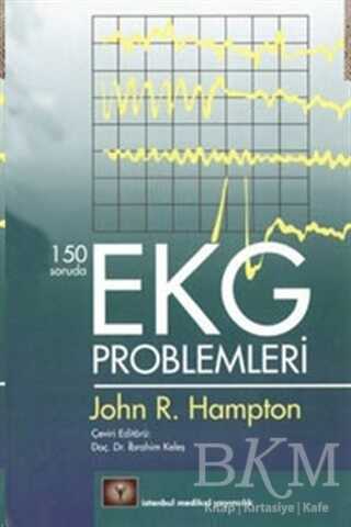 150 Soruda EKG Problemleri