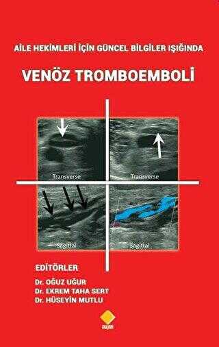 Aile Hekimleri İçin Güncel Bilgiler Işığında Venöz Tromboemboli - Duvar Kitabevi