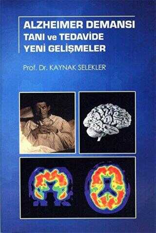 Alzheimer Demansı Tanı ve Tedavide Yeni Gelişmeler - 1