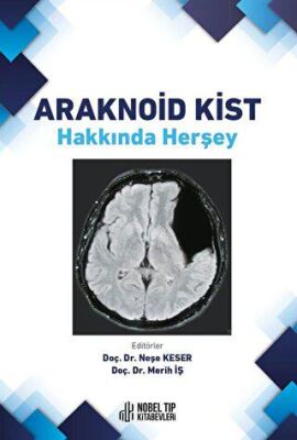 Araknoid Kist Hakkında Herşey - 1