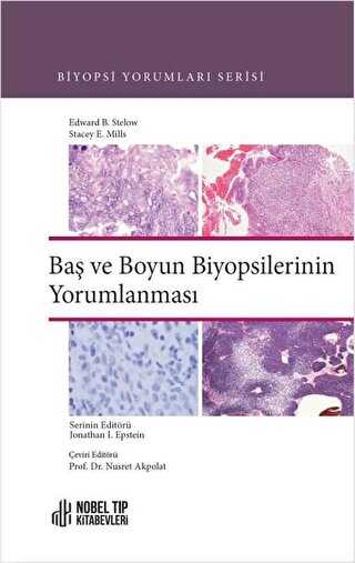 Baş ve Boyun Biyopsilerinin Yorumlanması - Nobel Tıp Kitabevi
