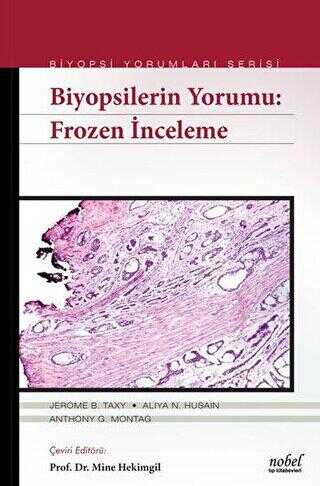 Biyopsilerin Yorumu: Frozen İnceleme - Nobel Tıp Kitabevi