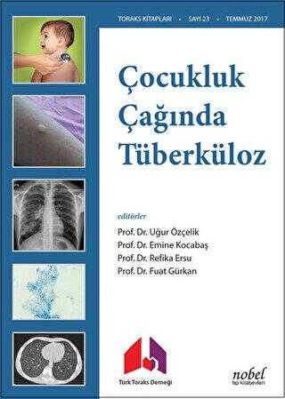 Çocukluk Çağında Tüberküloz - Nobel Tıp Kitabevi