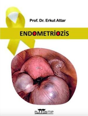 Endometriozis - 1