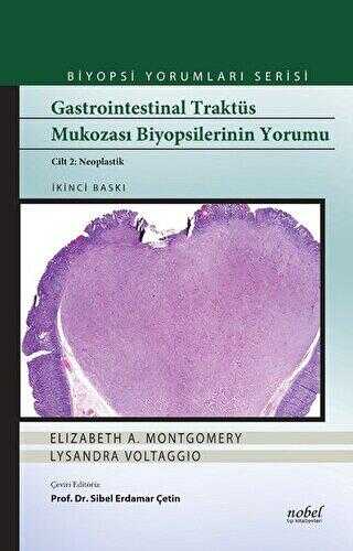 Gastrointestinal Traktüs Mukozası Biyopsilerinin Yorumu Cilt 2 Neoplastik - Nobel Tıp Kitabevi