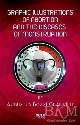 Graphic Illustrations Of Abortion And The Diseases Of Menstruation