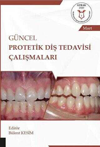 Güncel Protetik Diş Tedavisi Çalışmaları - Mart