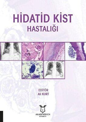 Hidatid Kist Hastalığı kapağı