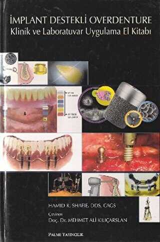 İmplant Destekli Overdenture - Palme Yayıncılık