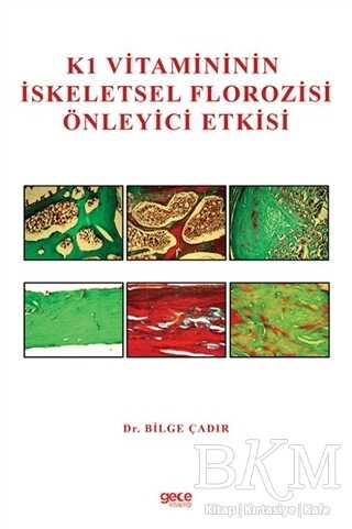 K1 Vitamininin İskeletsel Florozisi Önleyici Etkisi - 1
