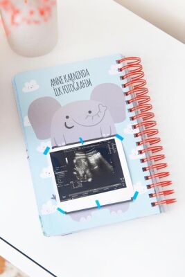 Le Color Bebek Anı ve Anne Hamile Günlüğü Albüm Defter Kız - 3