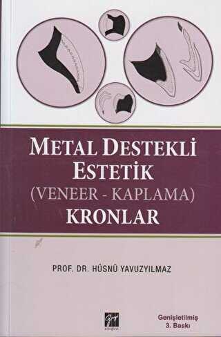 Metal Destekli Estetik Veneer-KaplamaKronlar - Gazi Kitabevi