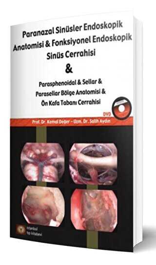 Paranazal Sinüsler Endoskopi Anatomisi & Fonksiyonel Endoskopik Sinüs Cerrahisi