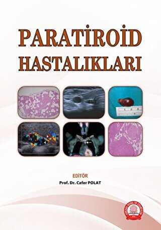 Paratiroid Hastalıkları - Ankara Nobel Tıp Kitabevi