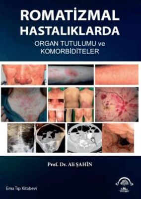 Romatizmal Hastalıklarda Organ Tutulumu ve Komorbiditeler - 1