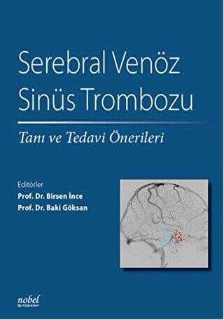 Serebral Venöz Sinüs Trombozu - Nobel Tıp Kitabevi