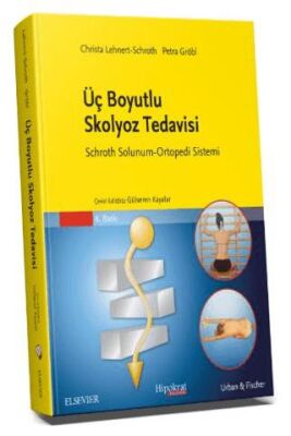 Üç Boyutlu Skolyoz Tedavisi - 1