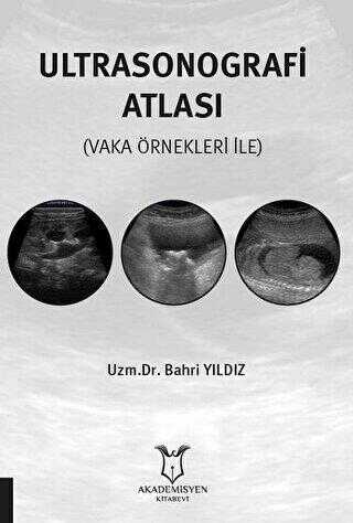 Ultrasonografi Atlası